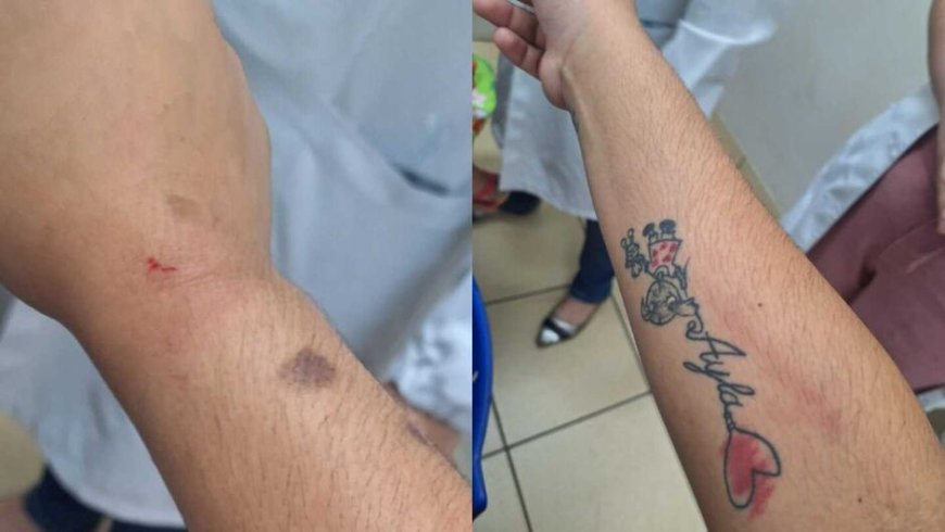 Mãe com criança no colo é agredida por enfermeira na UPA do Nova Bahia em Campo Grande