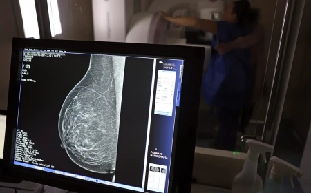 Debate Sobre Mamografia Ganha Força Após Estudo Revelar Câncer de Mama Mais Agressivo em Mulheres Jovens
