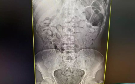 Jovem boliviano é flagrado com cápsulas de cocaína durante fiscalização na fronteira