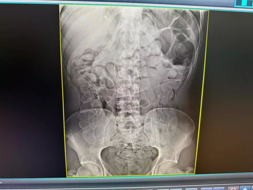 Jovem boliviano é flagrado com cápsulas de cocaína durante fiscalização na fronteira