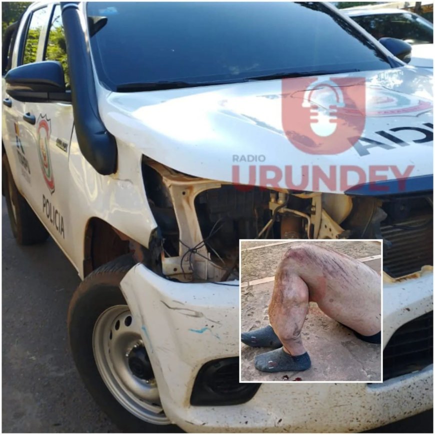 Motociclista sofre fratura em colisão com viatura policial