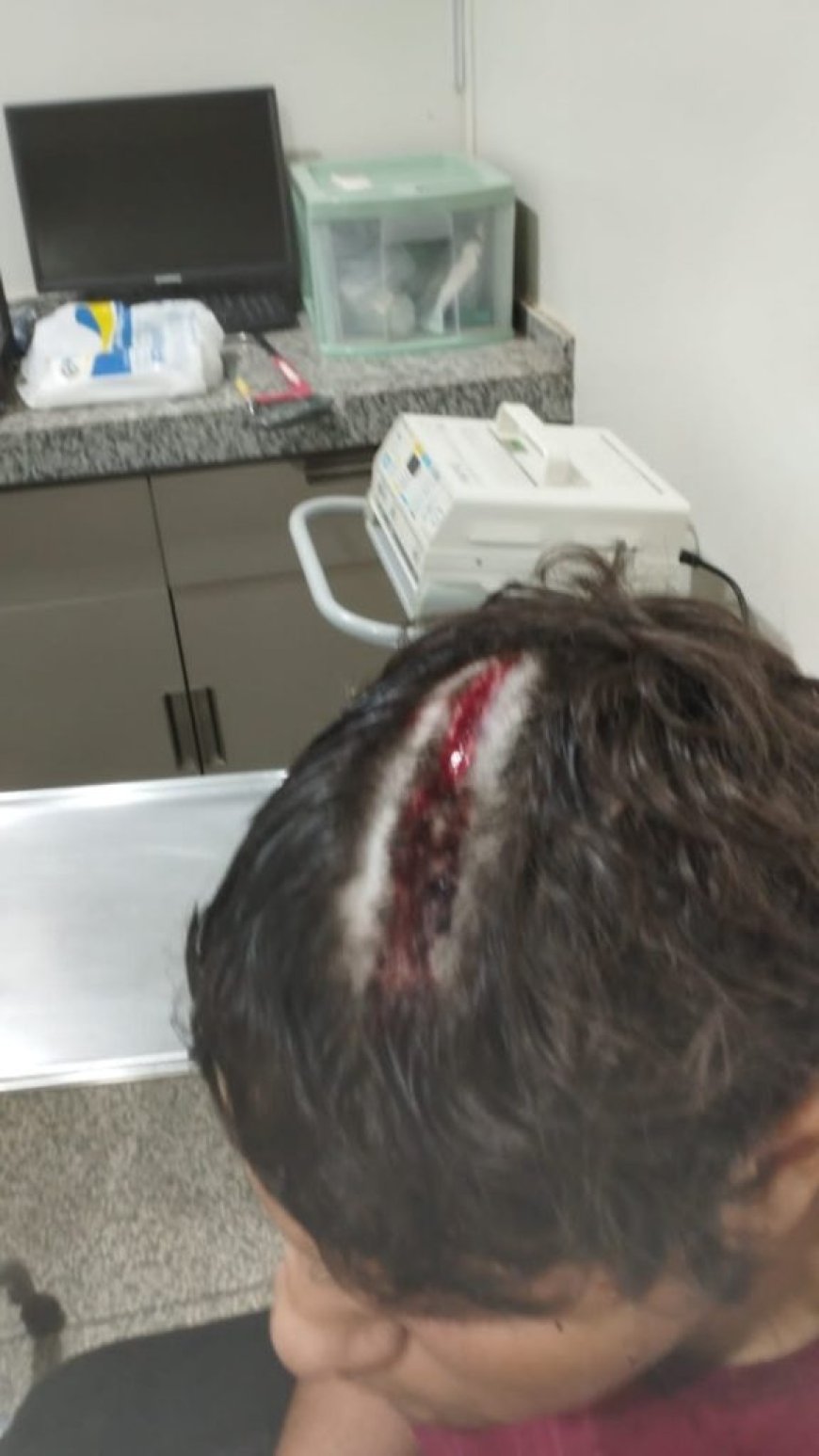 Ação conjunta das polícias resulta na prisão de jovem por homicídio em Sonora