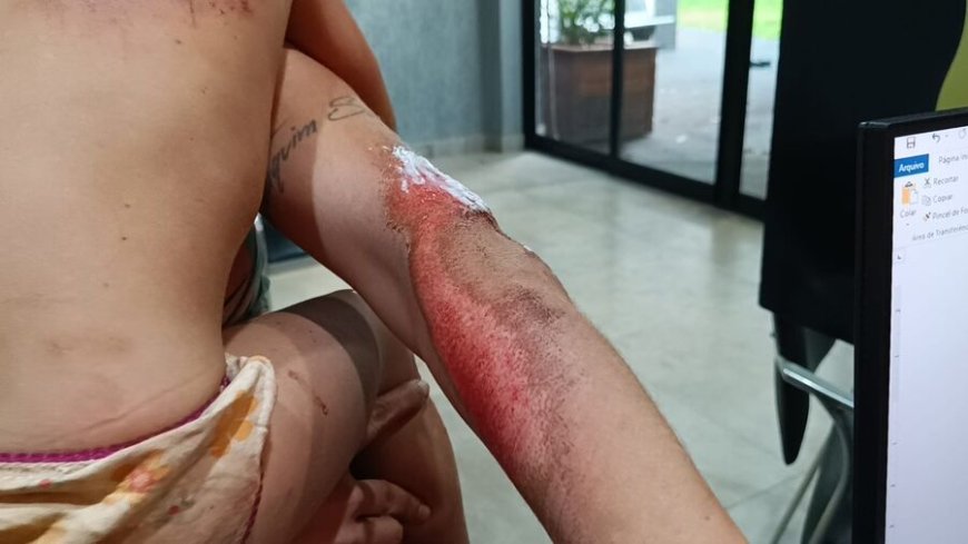 Mulher e criança de dois anos são arrastadas por veículo após desentendimento com motorista