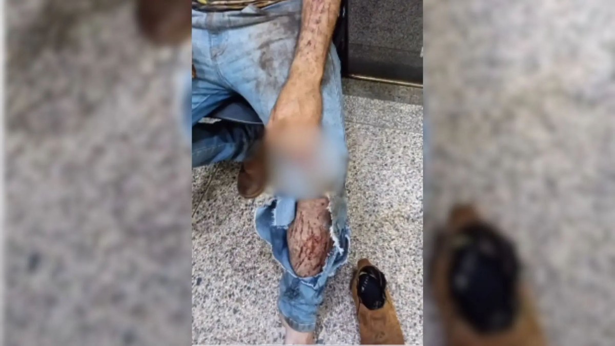 Morador é atacado por onça durante colheita em Ponta Porã