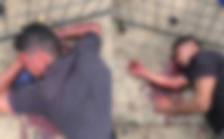 Briga deixa homem ferido na cabeça em Campo Grande