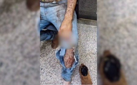 Morador é atacado por onça durante colheita em Ponta Porã