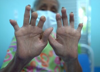 Menos atenção e recursos: doenças negligenciadas seguem como desafio