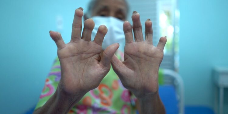 Menos atenção e recursos: doenças negligenciadas seguem como desafio