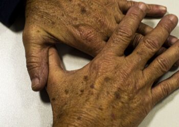 Brasil projeta 781 mil novos casos de câncer por ano até 2028