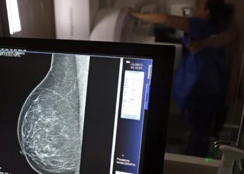 Estudo com RNA tem método que pode ajudar a tratar câncer de mama