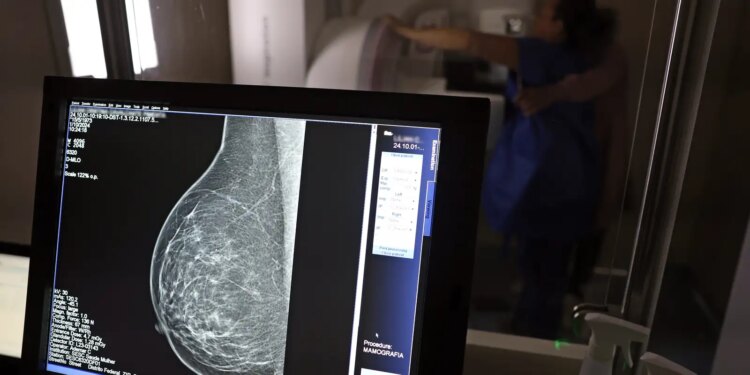 Estudo com RNA tem método que pode ajudar a tratar câncer de mama