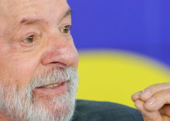 Lula tem evolução satisfatória após cirurgia de catarata