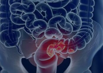 Campanha Março Azul alerta para a prevenção do câncer colorretal