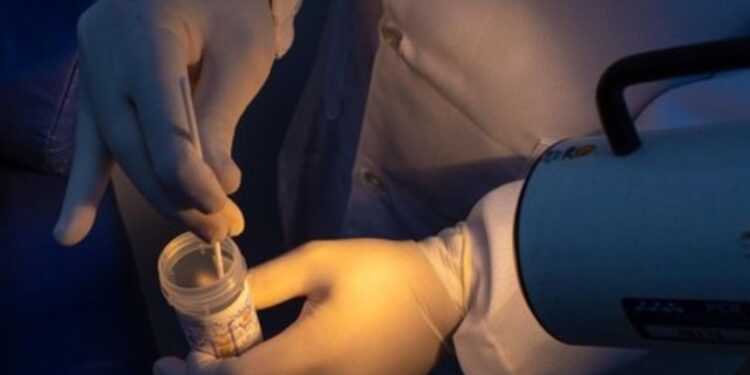 Projeto busca ampliar rastreamento do câncer do colo do útero no SUS