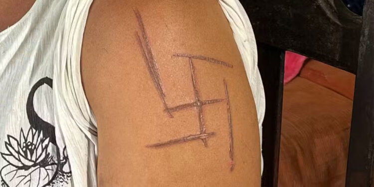 Mulher trans é torturada e marcada com símbolo nazista em MS