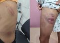 Menino autista é agredido dentro e fora de escola em Campo Grande