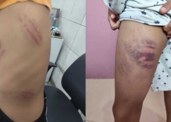 Menino autista é agredido dentro e fora de escola em Campo Grande