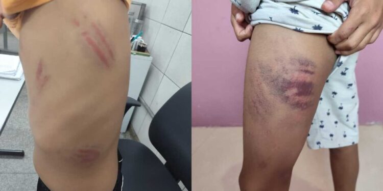 Menino autista é agredido dentro e fora de escola em Campo Grande