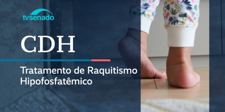 CDH debate tratamento do raquitismo no SUS - 23/4/26