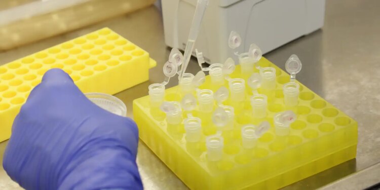 São Paulo confirma segundo caso importado de sarampo no estado em 2026